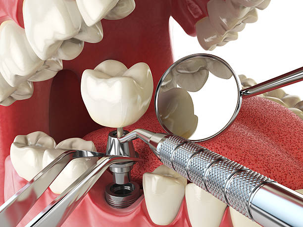 Best Knocked-Out Tooth Emergency  in Kent Acres, DE